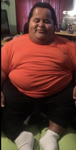 Expose and fuck a disabled superchub