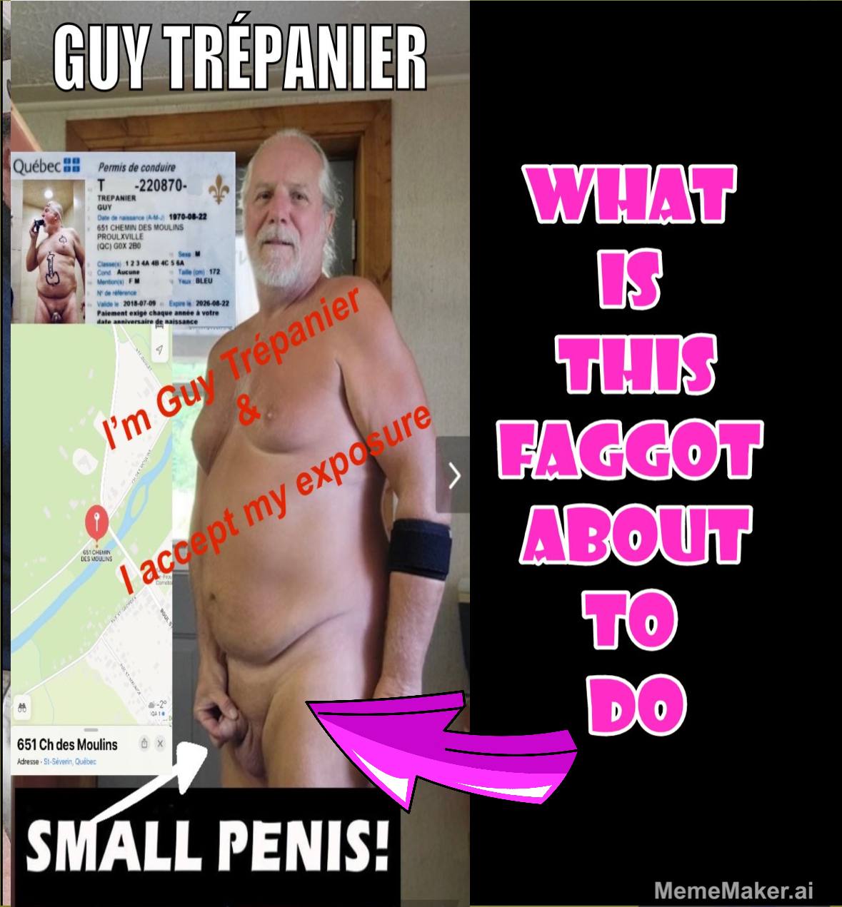 Tiny Dick f*ggot Guy Trepanier exposed naked