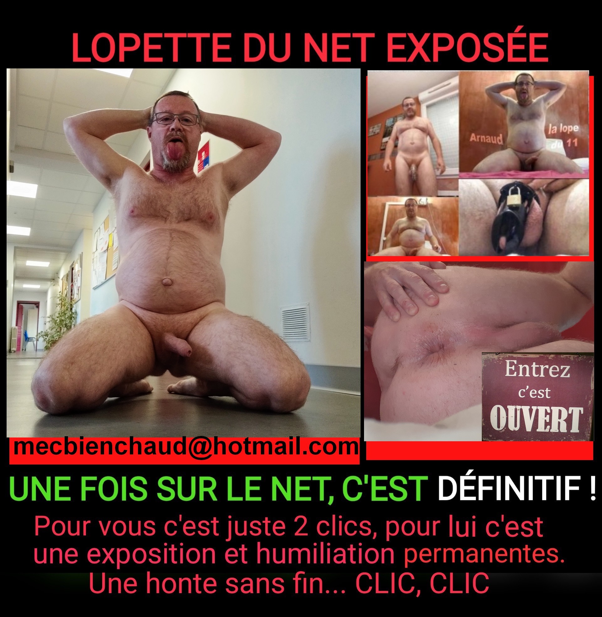 Lopette du 11