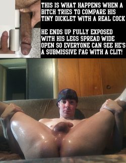 Seth Fox has a tiny dick!