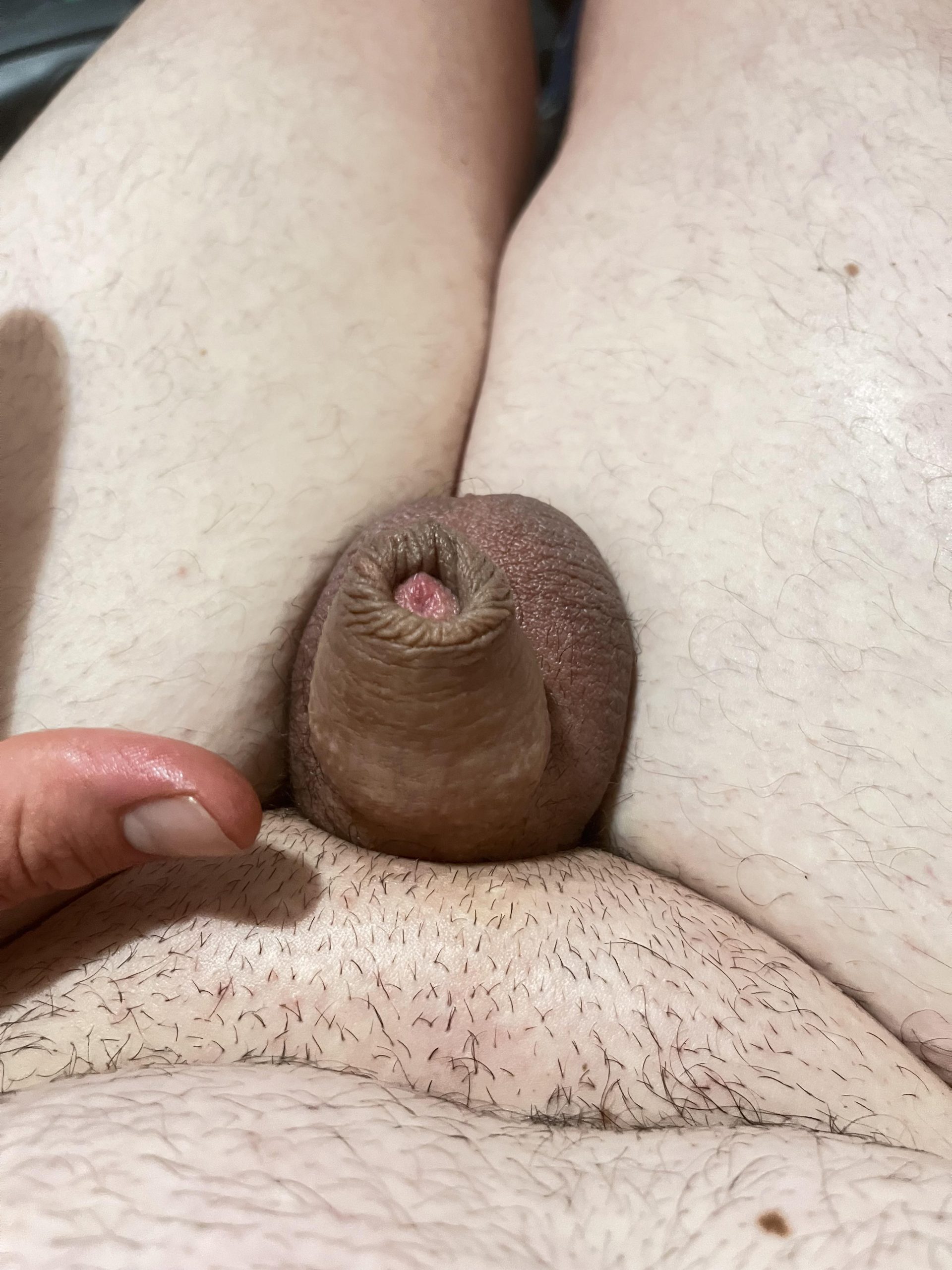 Bobby “BetaloserBobbi” Simpson  – Bobbied(aka humiliated/body shamed)