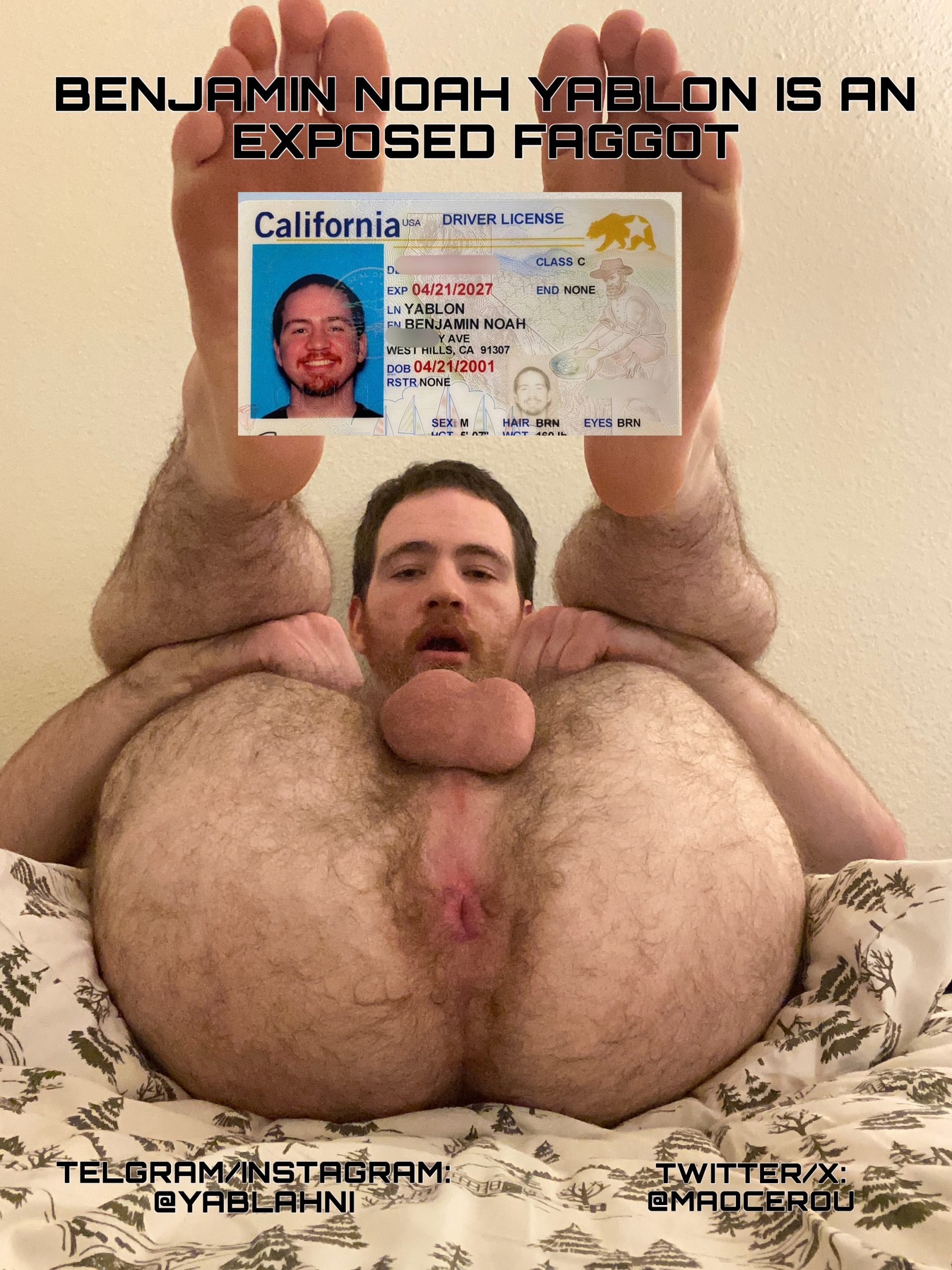 Benny Yablon’s f*ggot Exposure