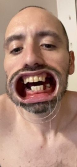 GrossmouthBobby – Disgusting pathetic loser close up of face