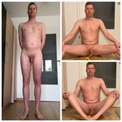 Jan Klein – Zähringer Straße 12, 79108 Freiburg – Medartis GmbH – Naked