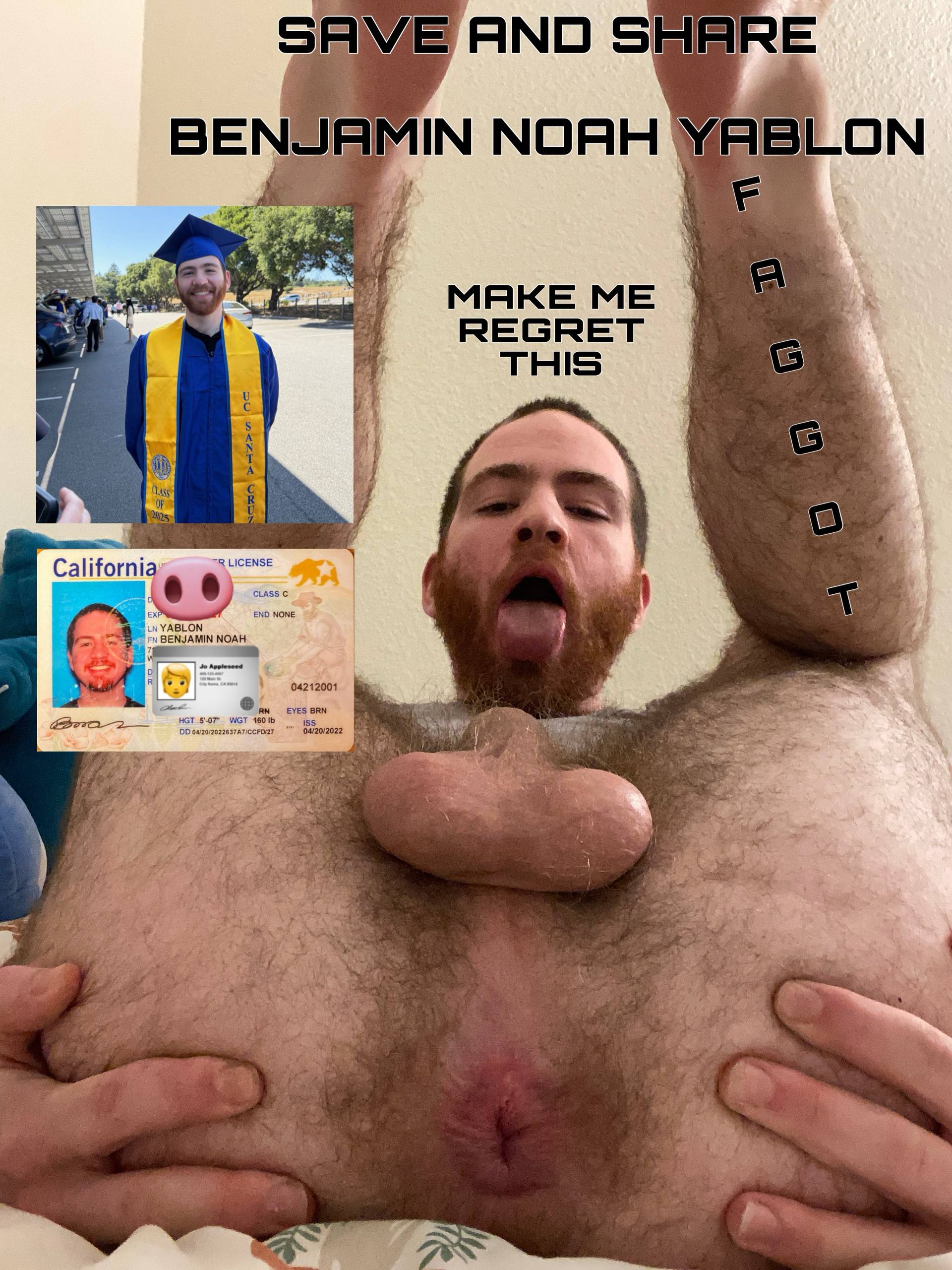 Benny Yablon’s f*ggot Exposure