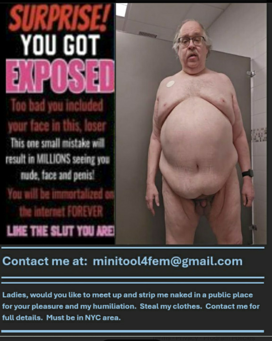 Tiny Dick Dude to be Exposed Everywhere, and Then Some!