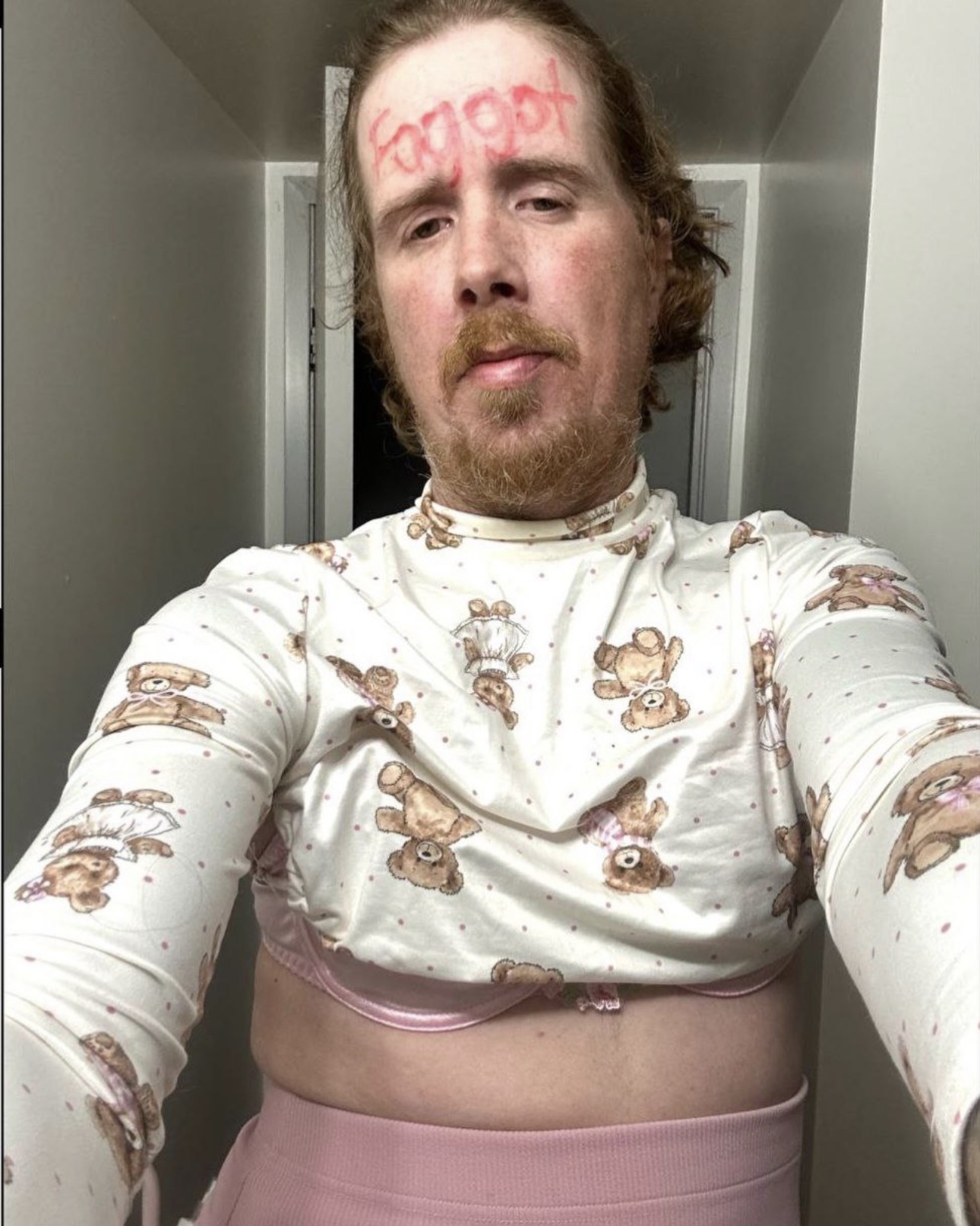 Desperate Drunk f*ggot