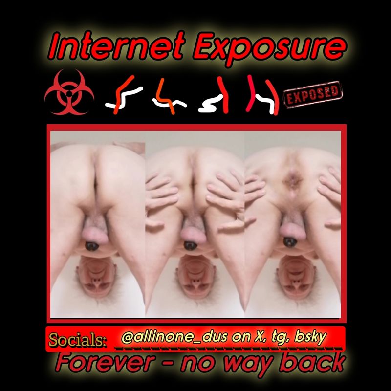 Allinone_dus  – Total Exposure f*g Allinone