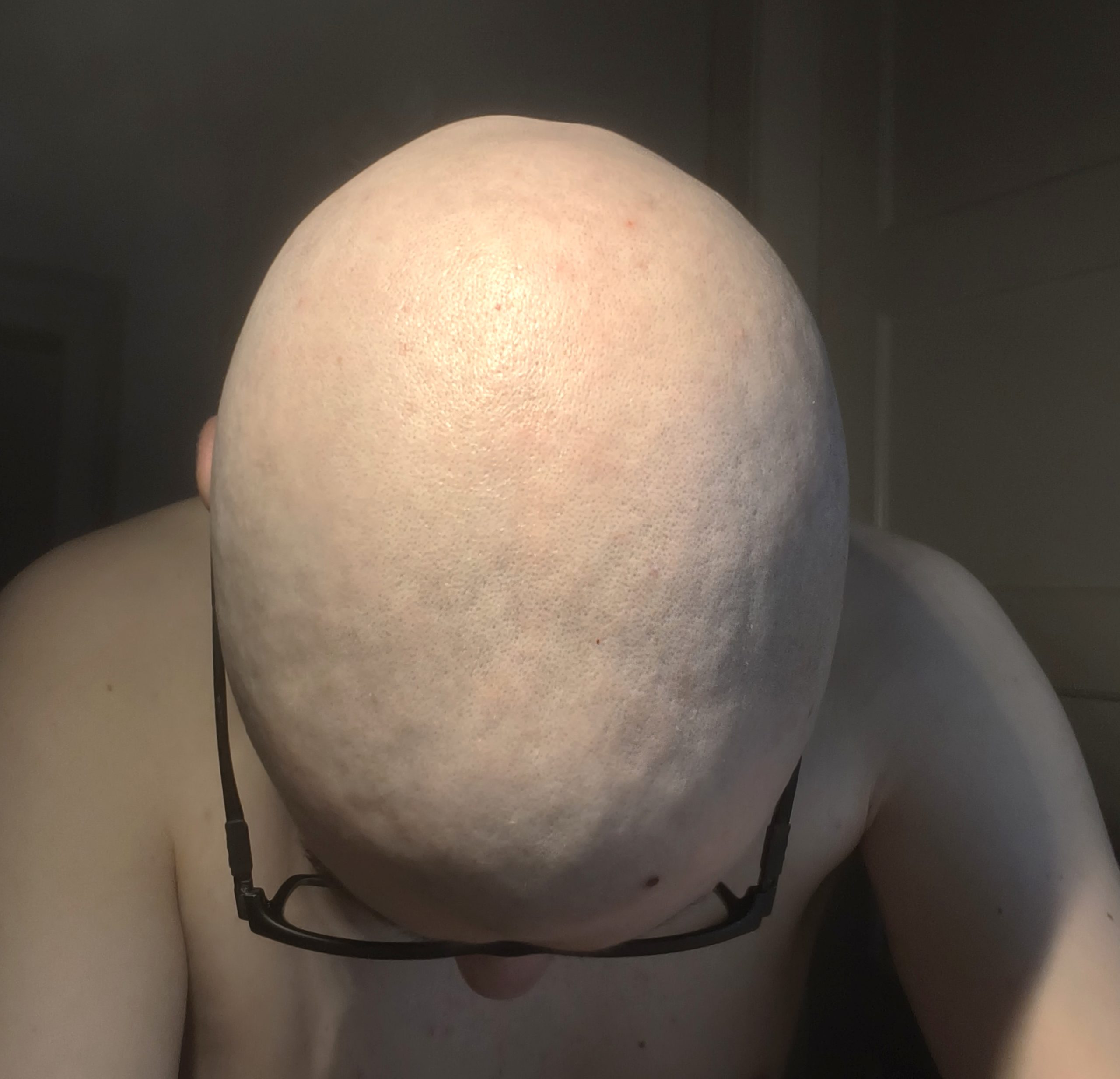 Fresh Headshave from 3mm to 0mm – fabiansc90