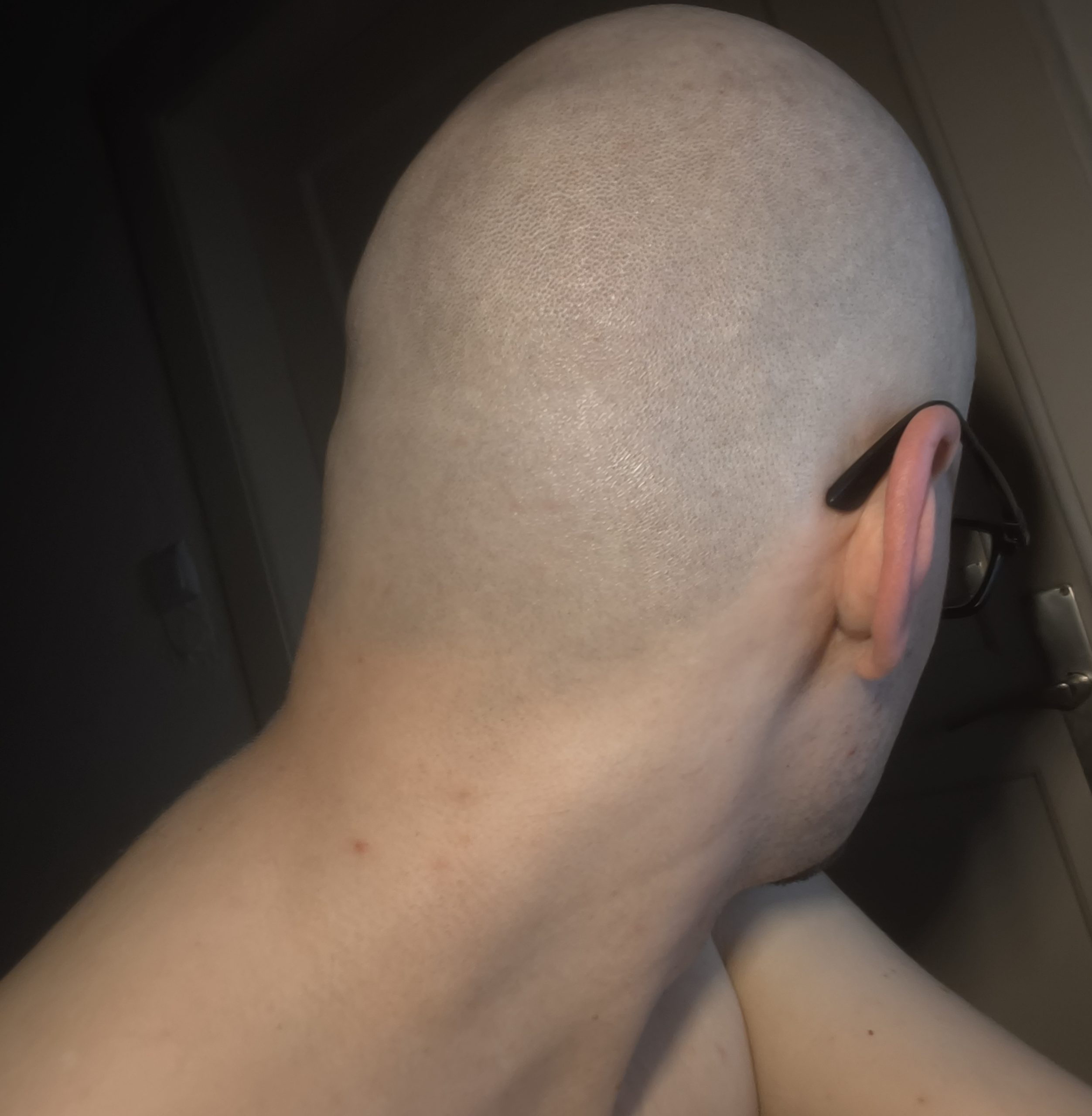 Fresh Headshave from 3mm to 0mm – fabiansc90