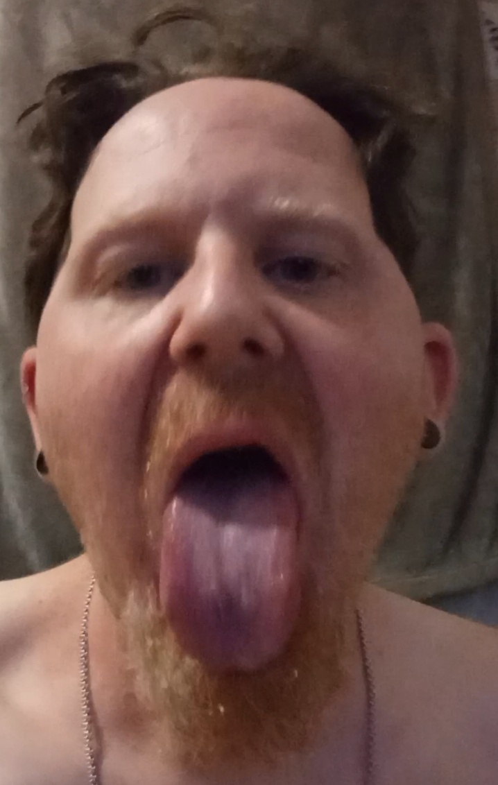Phillip the sissy bitch