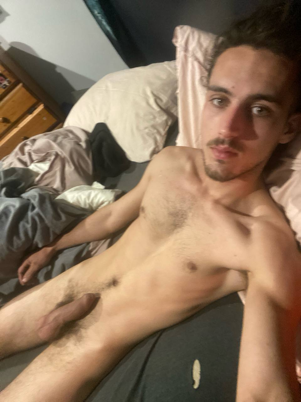 Exposed f*g