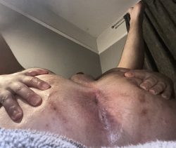 Exposed f*ggot Hole