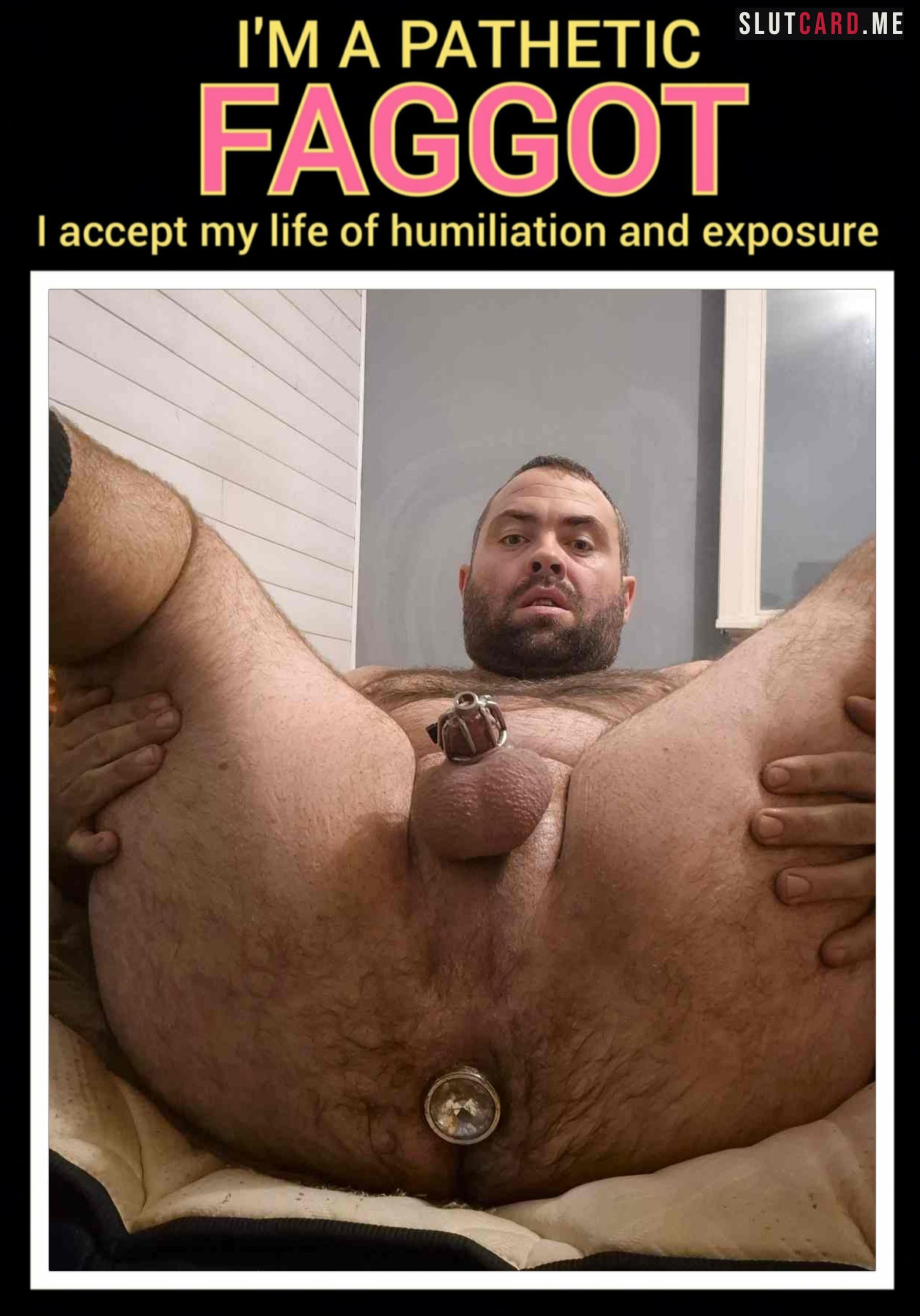 f*g jimmy