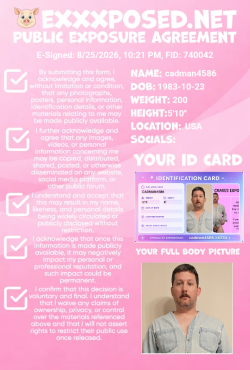 Microdick sissy loser