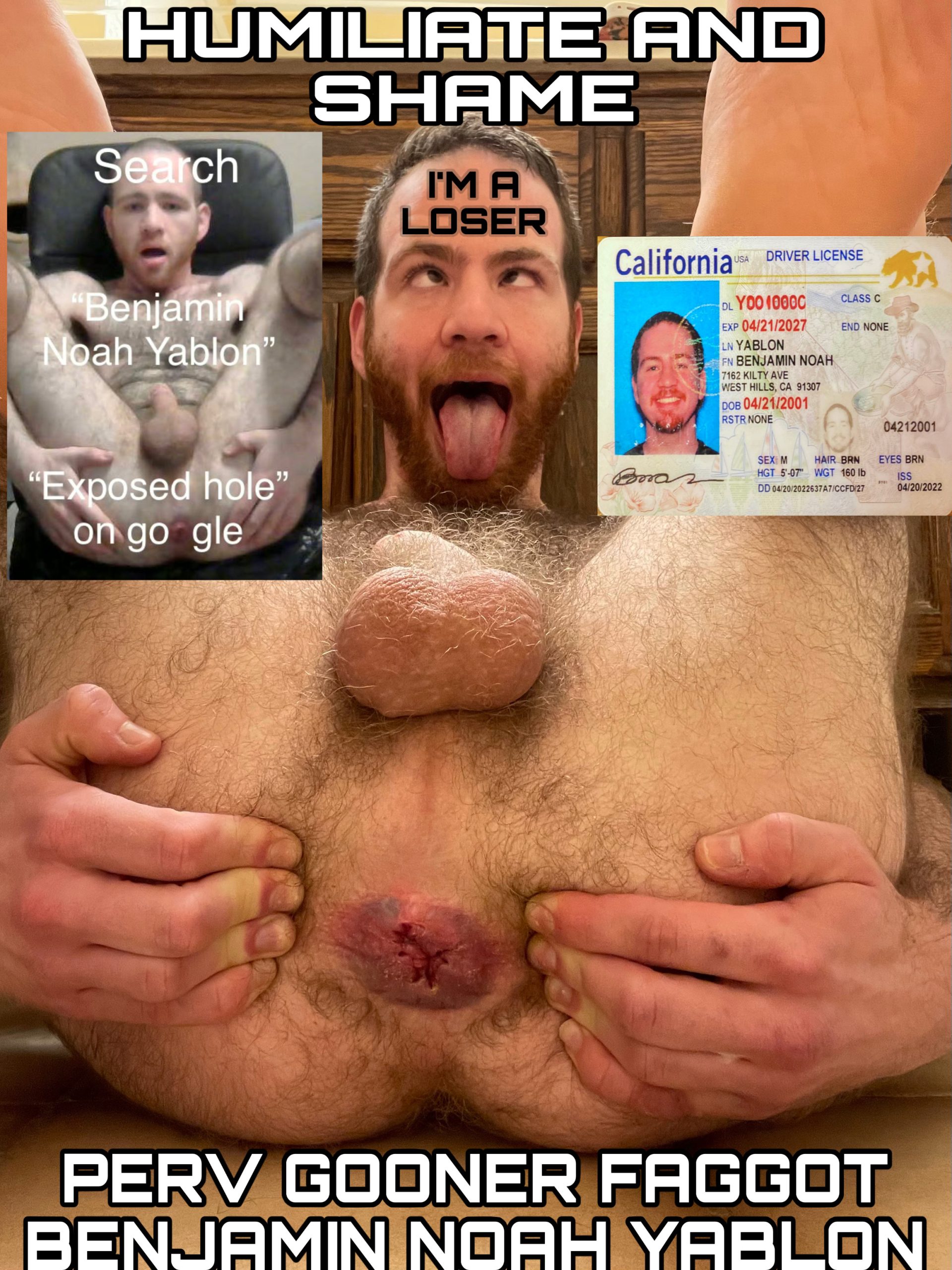 Benjamin’s Extreme Exposure