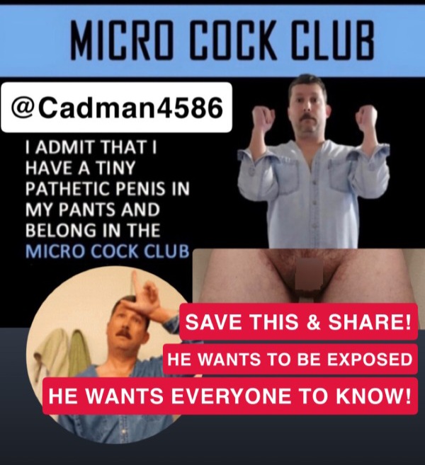 Exposed fag
