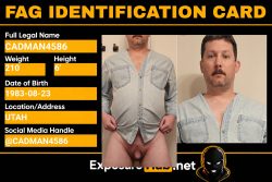 Exposed f*g