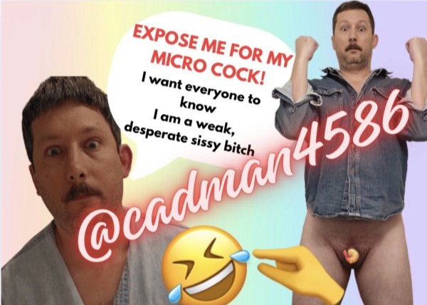Exposed fag