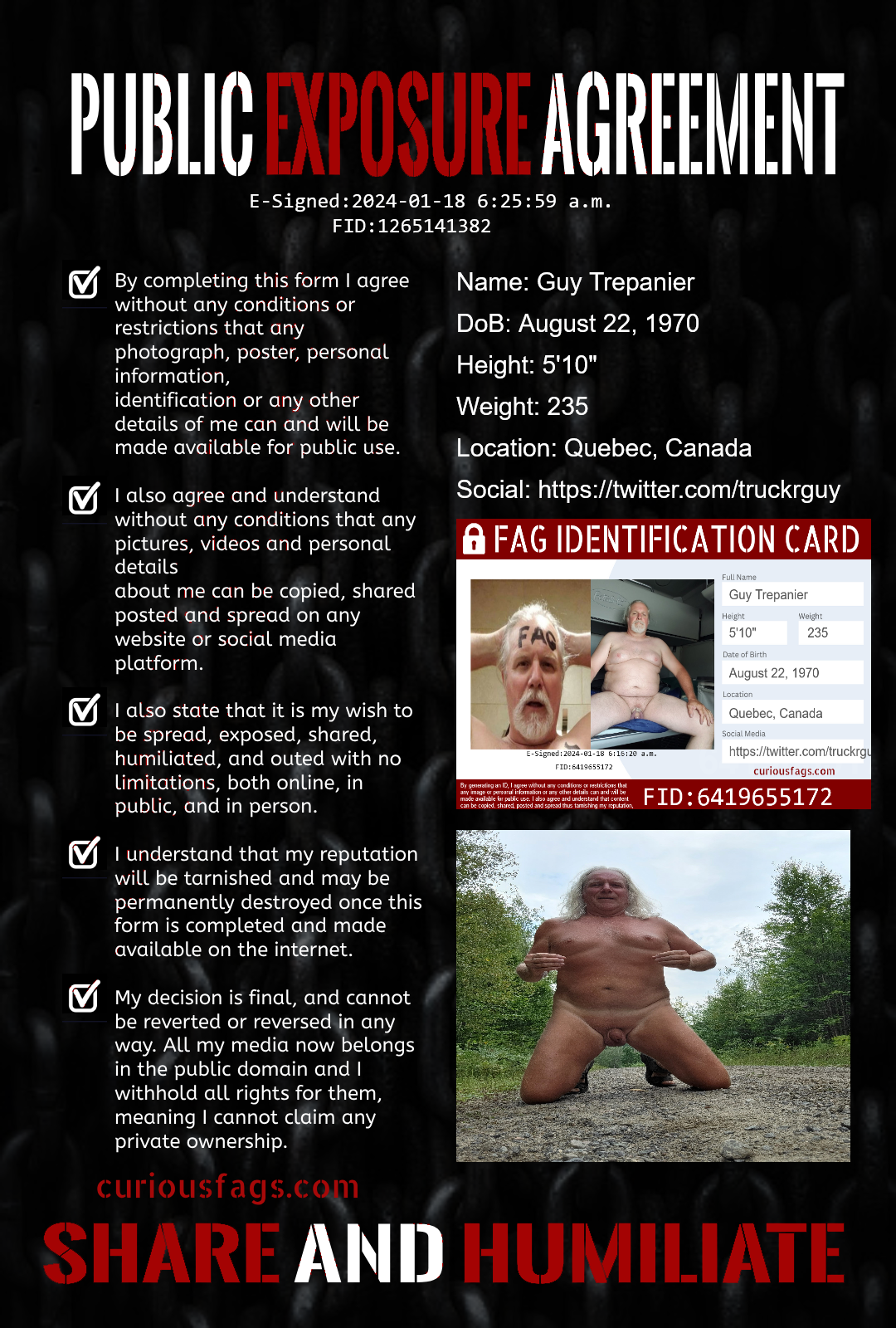 Tiny Dick faggot Guy Trepanier exposed forever No Delete