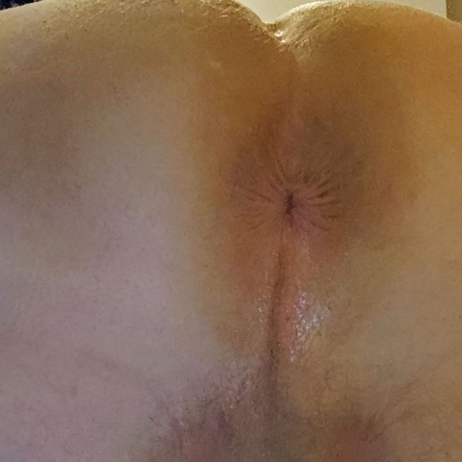 Dutch bottom hole exposed